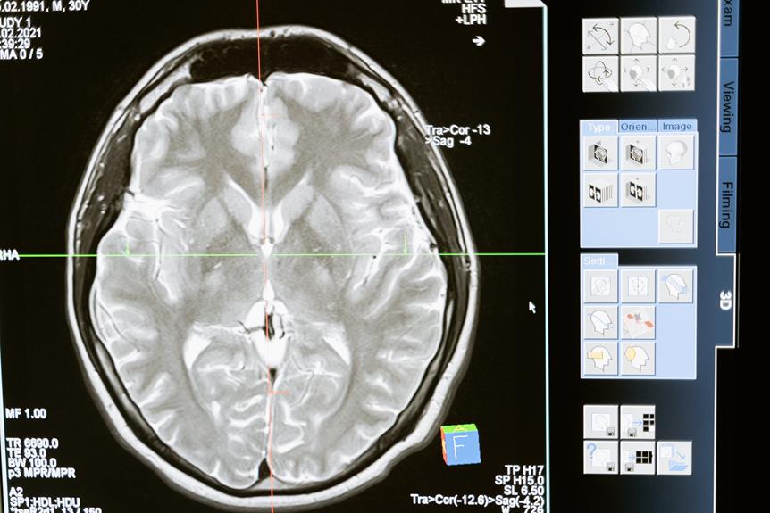 Longterm_Alcohol_Use_Impact_on_Brain_Health