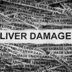 What Are the Signs of Alcohol-Induced Liver Damage?